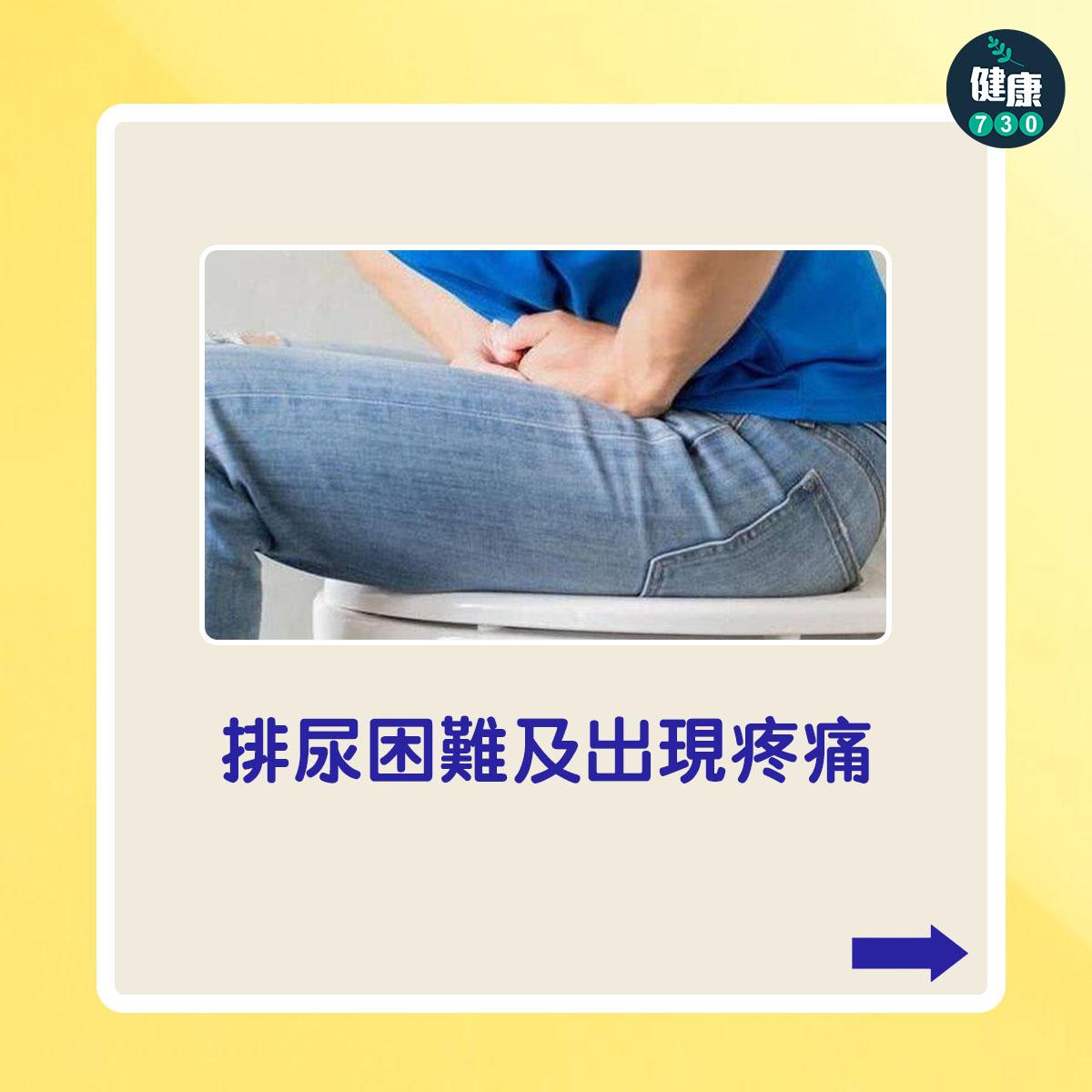 排尿困難及出現疼痛