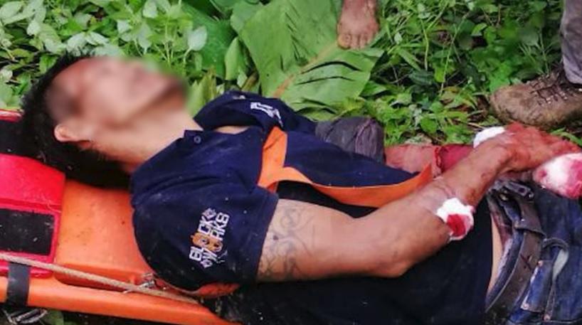 Manee雙手等多處受傷。(互聯網)