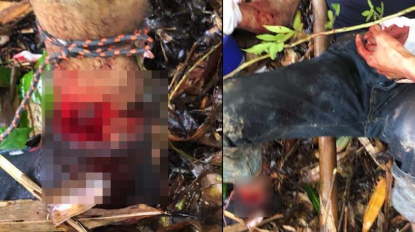 Manee身體多處受傷。(互聯網)