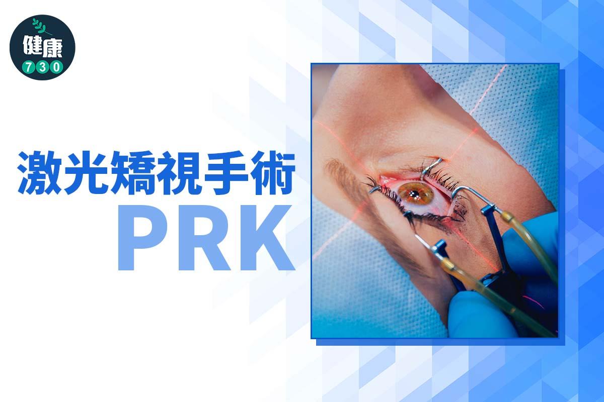 激光矯視手術