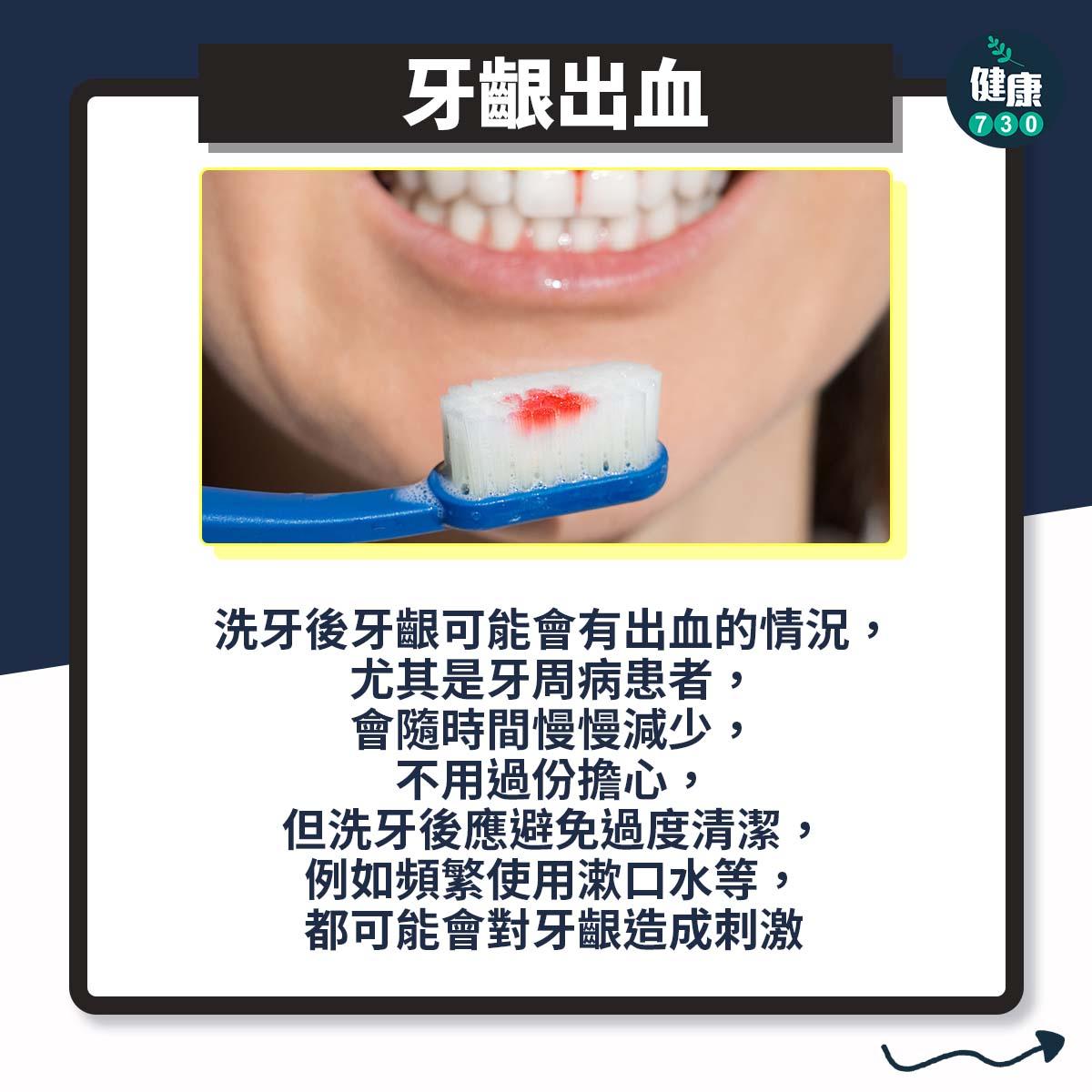 洗牙問題|牙齦出血