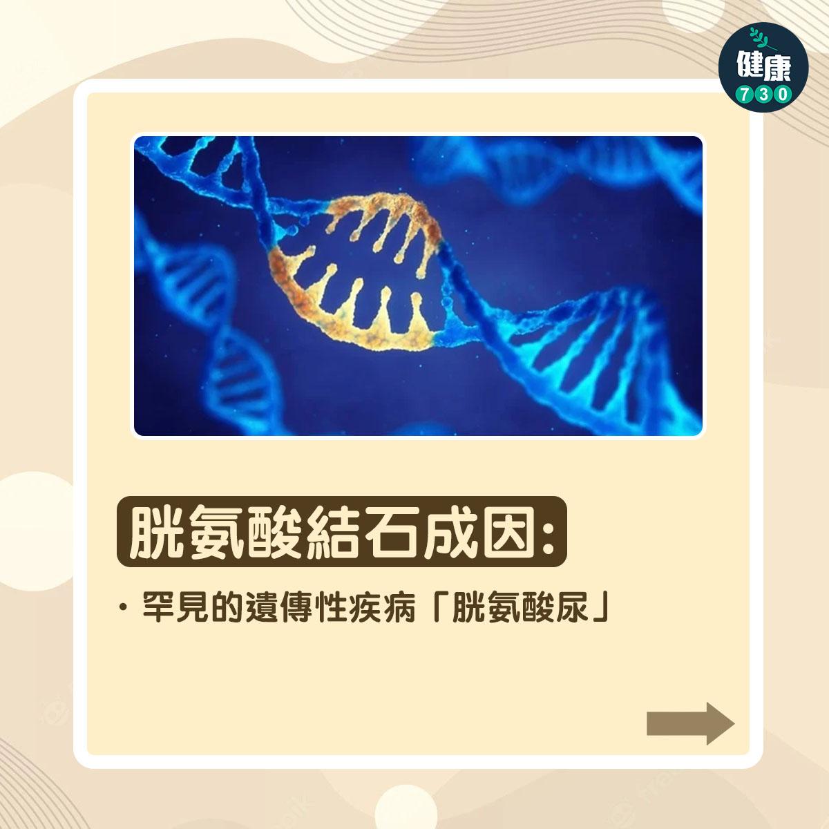 胱氨酸結石成因