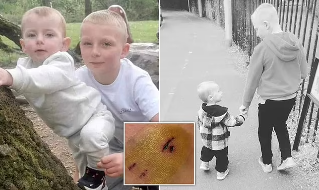 Caio保護弟弟導致自己狗咬傷備受讚賞。(互聯網)