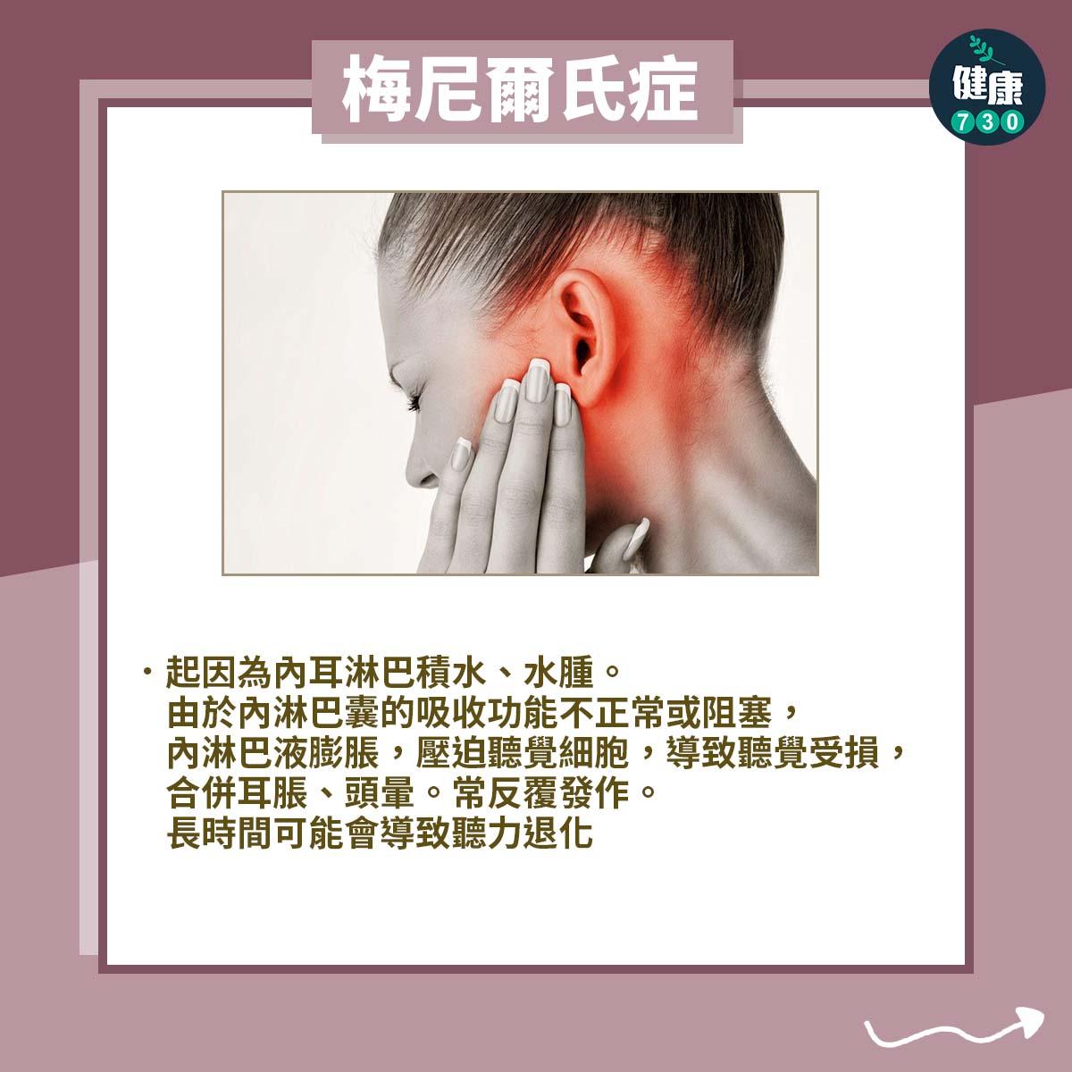 頭暈|眩暈疾病包括梅尼爾氏症、前庭型偏頭痛及椎基底動脈循環不全。(am730製圖)