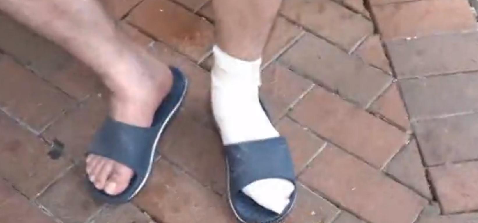 兄弟其中一人走火警時腳受傷。