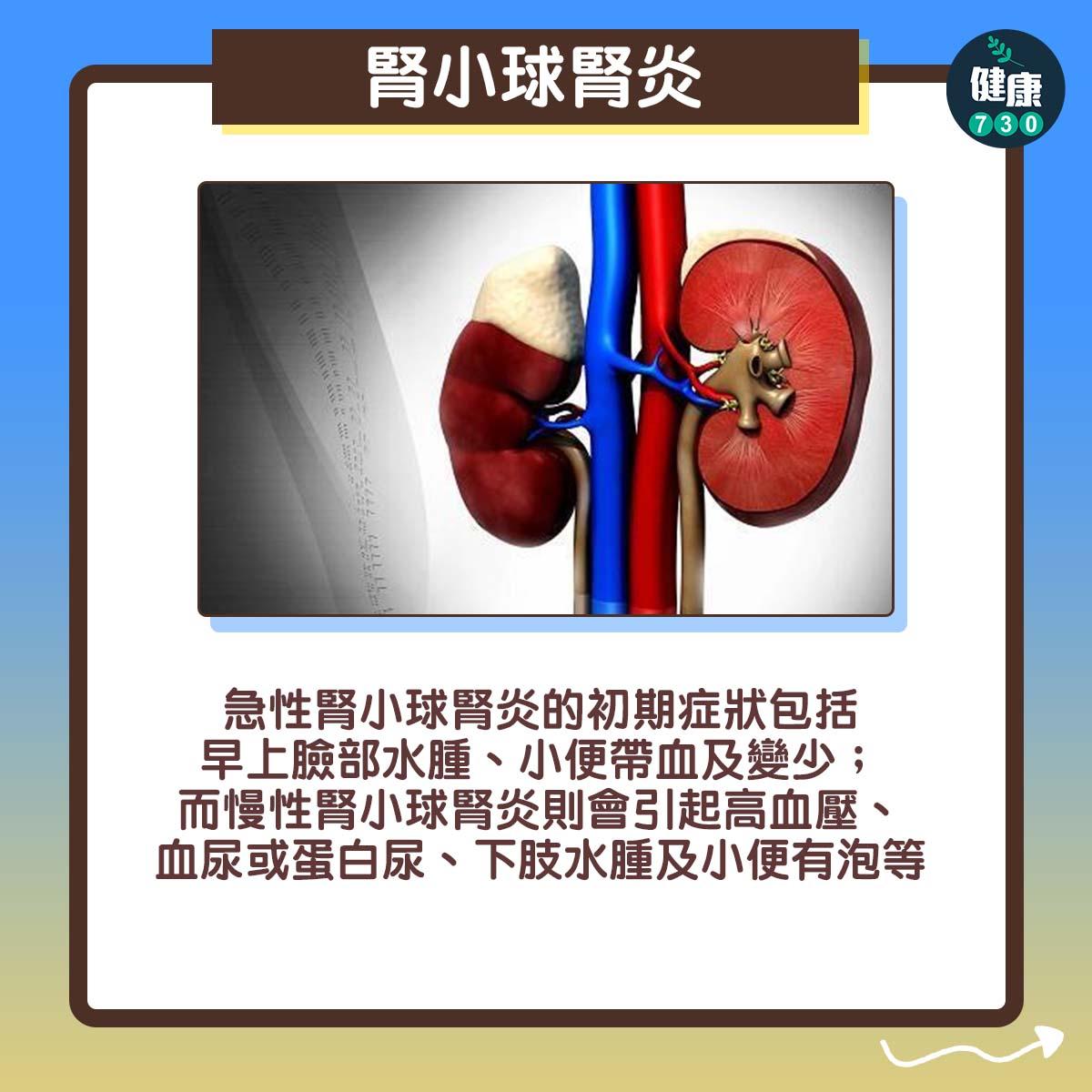 水腫|自我測試(am730製圖)