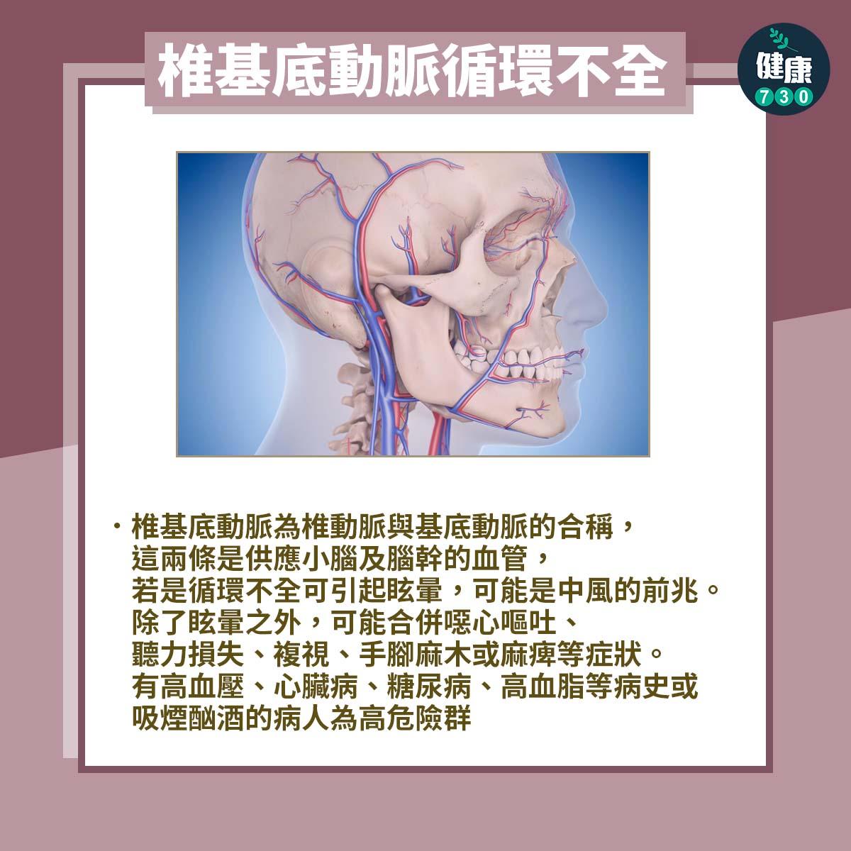 頭暈|眩暈疾病包括梅尼爾氏症、前庭型偏頭痛及椎基底動脈循環不全。(am730製圖)