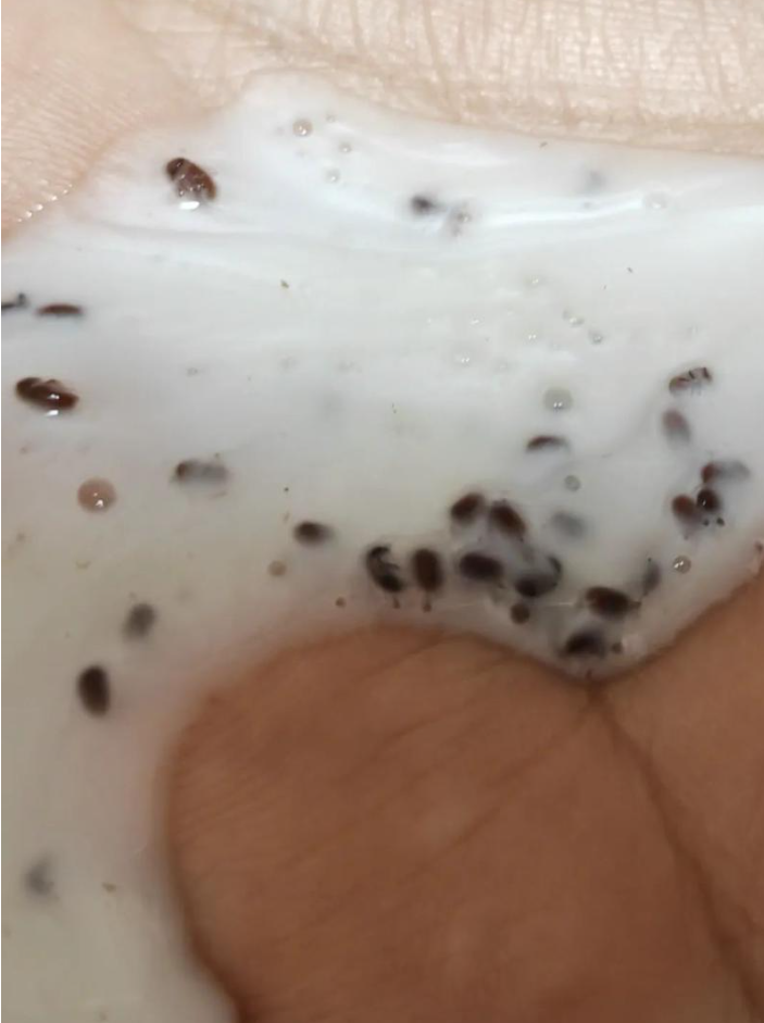 女子上網買Head&Shoulders洗頭水壓擠出50多隻蟲卵 客戶:有頭有腳似曱甴