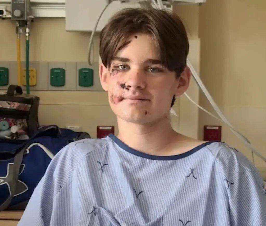 墮崖的13歲少年Wyatt Kauffman。