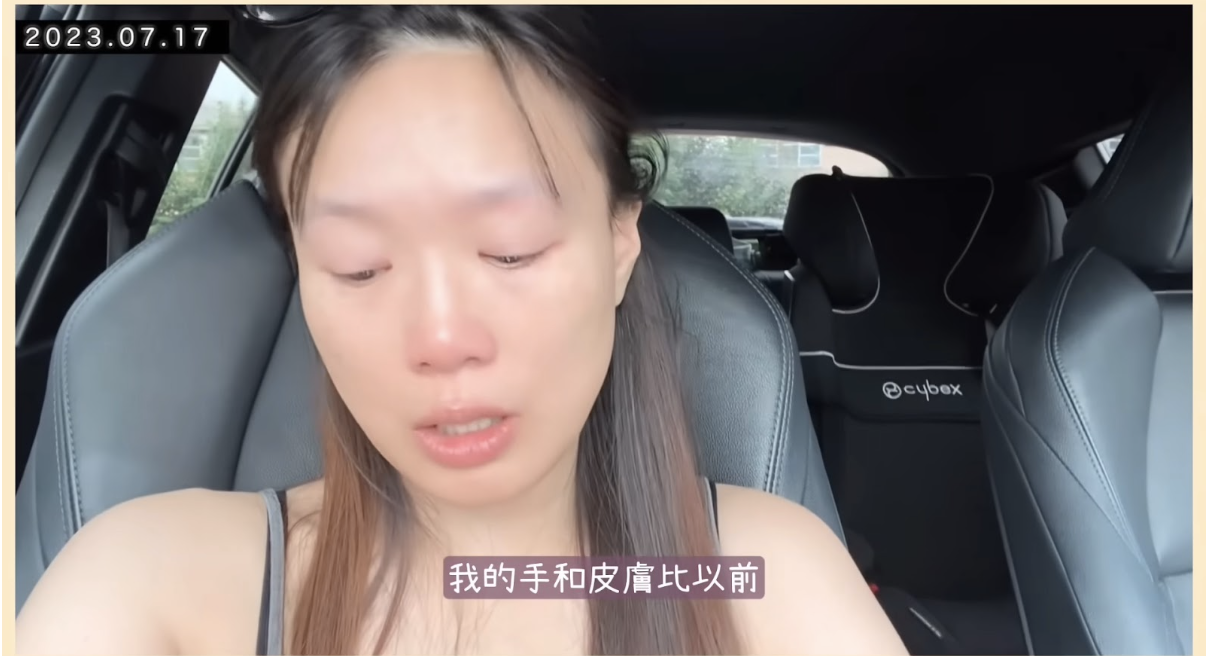 皮膚在生活兩年幾亦仍未適應,令她無所適從。(圖片來源:YouTube@glorykasumi)