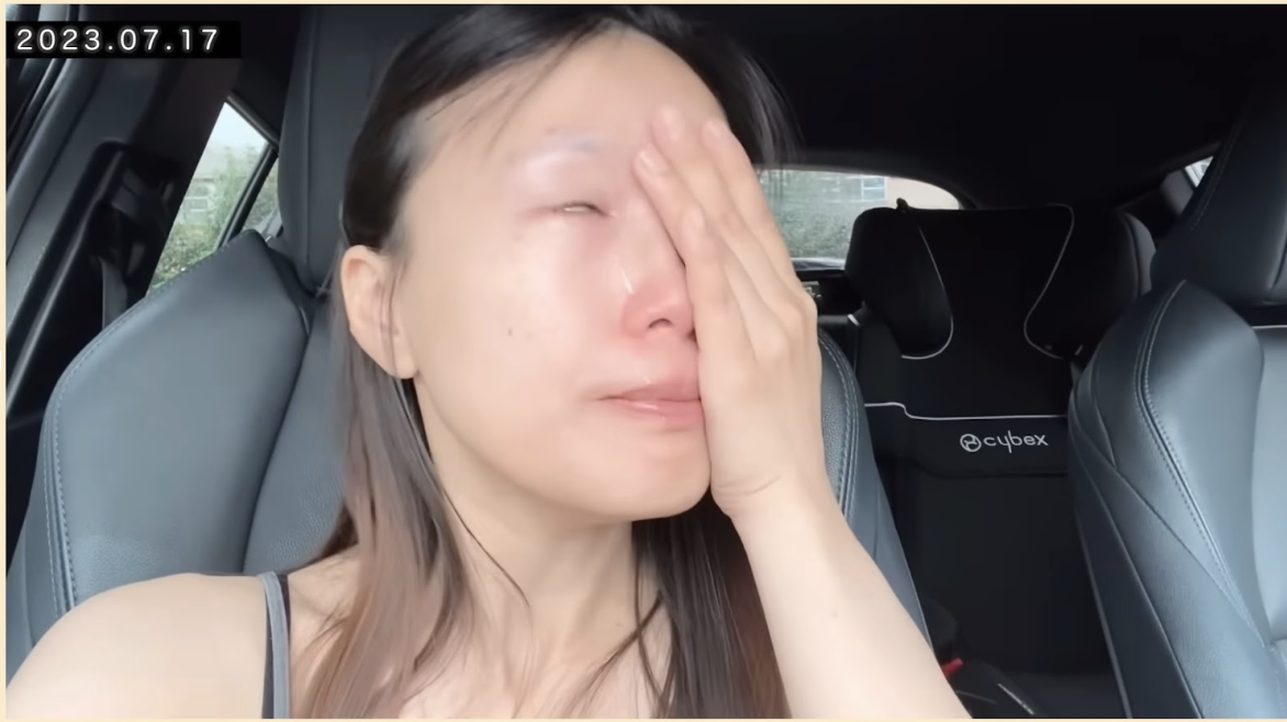 皮膚在生活兩年幾亦仍未適應,令她無所適從。(圖片來源:YouTube@glorykasumi)