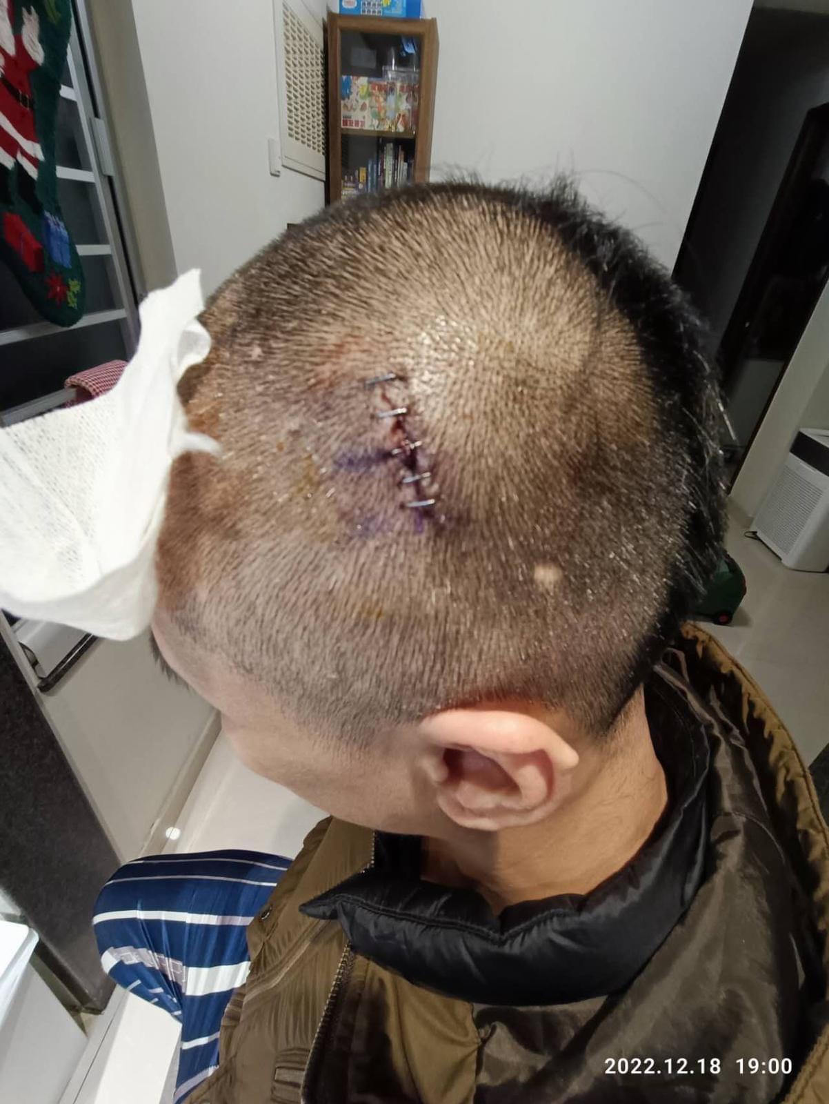 今年周永恆傳遭家暴,後來有傳他家暴太太而非受害者。