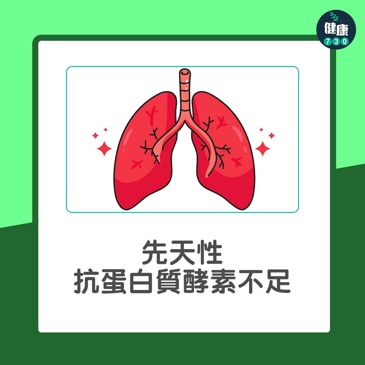 肺部健康|慢性阻塞性肺病高危因素(am730製圖)