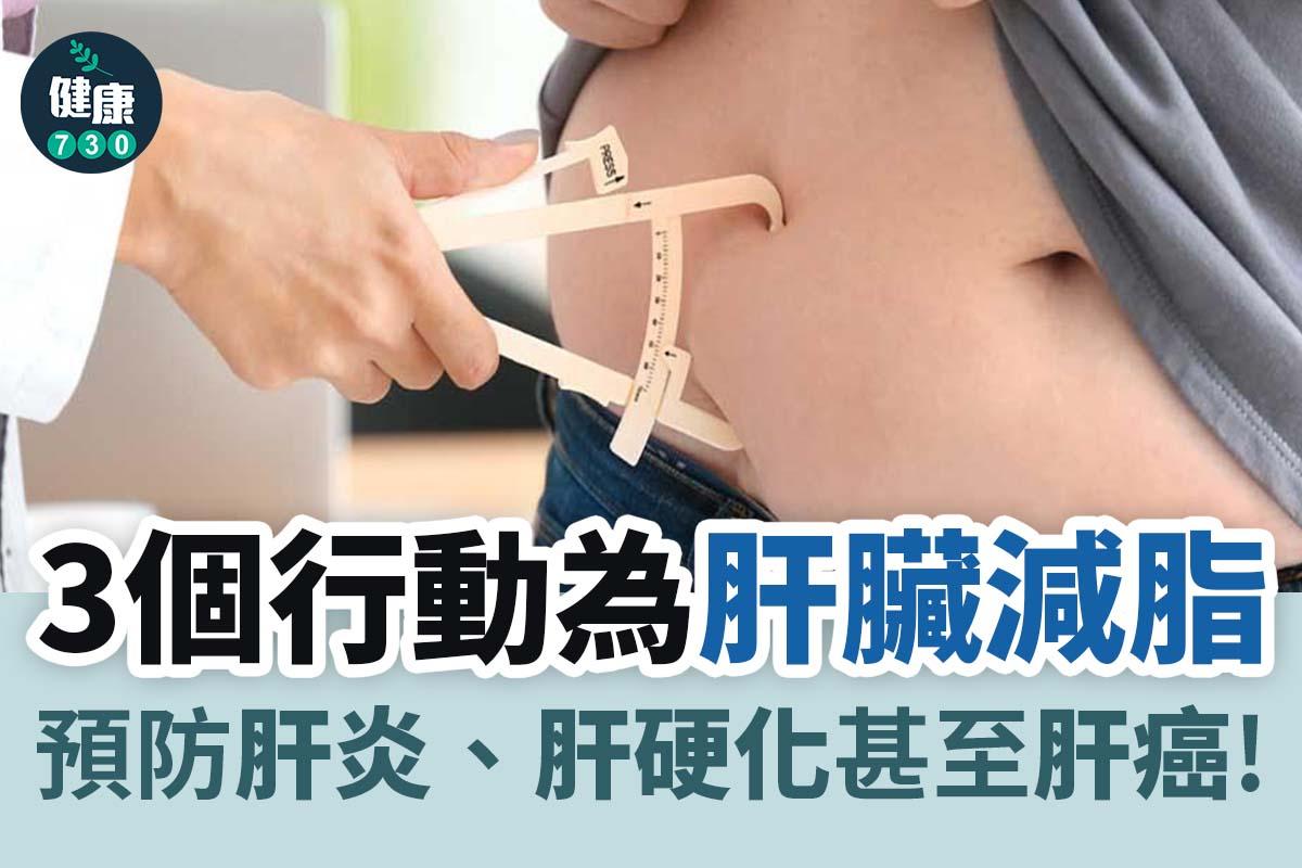 脂肪肝|3個行動為肝臟減脂 防肝炎癌變保健康 (am製圖)