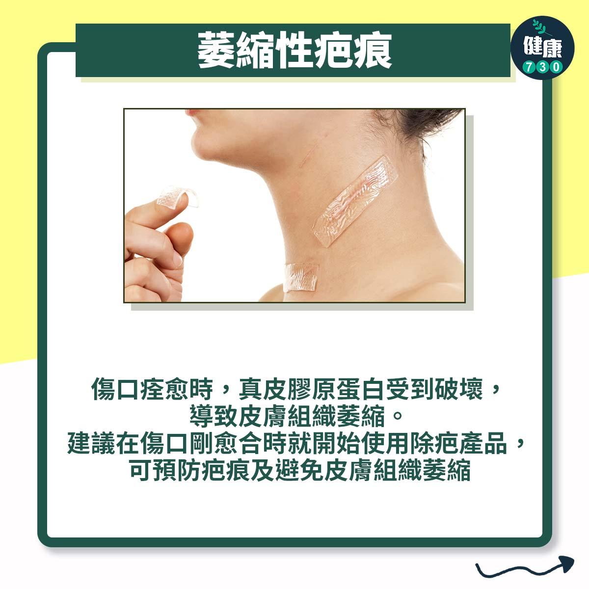 疤痕3大種類處理方法