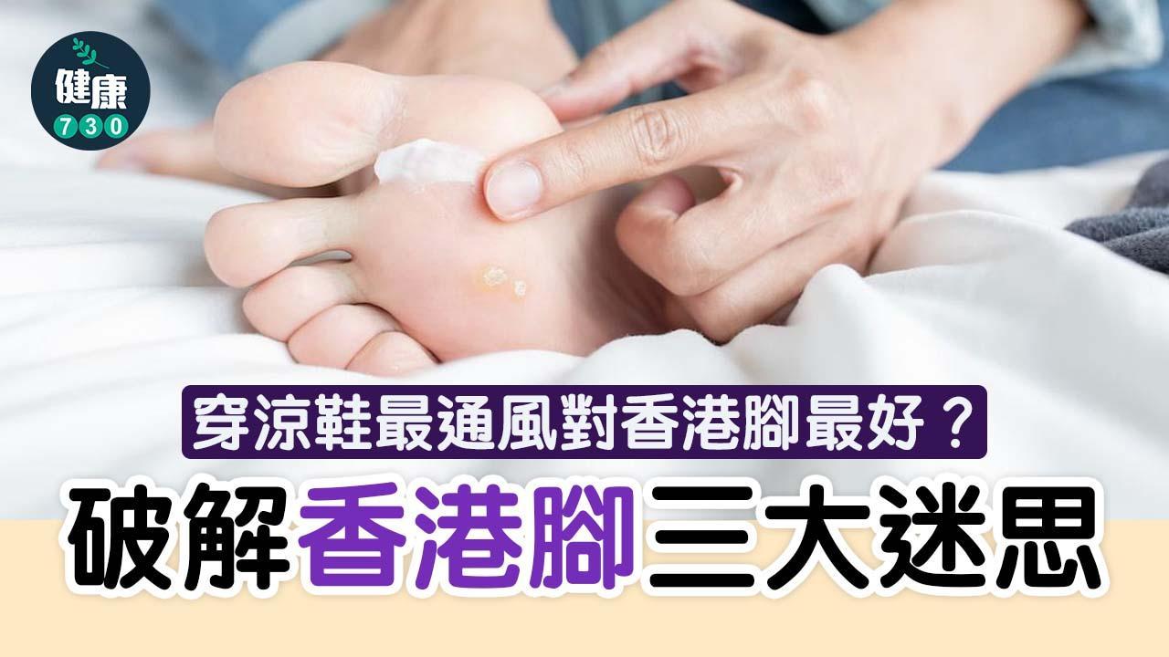 香港腳症狀4大型態(am730)