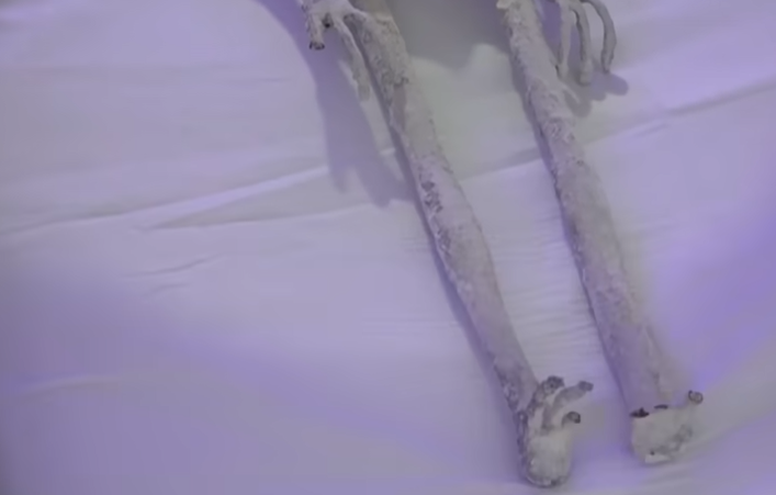 外星人遺骸|X光及電腦掃瞄結果指「外星人遺骸」未經人為接駁組裝。(互聯網)