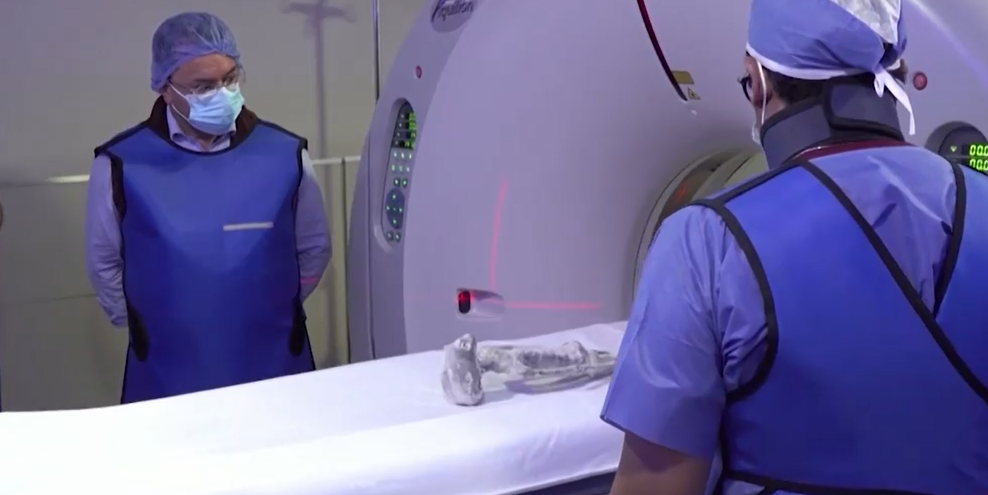 外星人遺骸|X光及電腦掃瞄結果指「外星人遺骸」未經人為接駁組裝。(互聯網)