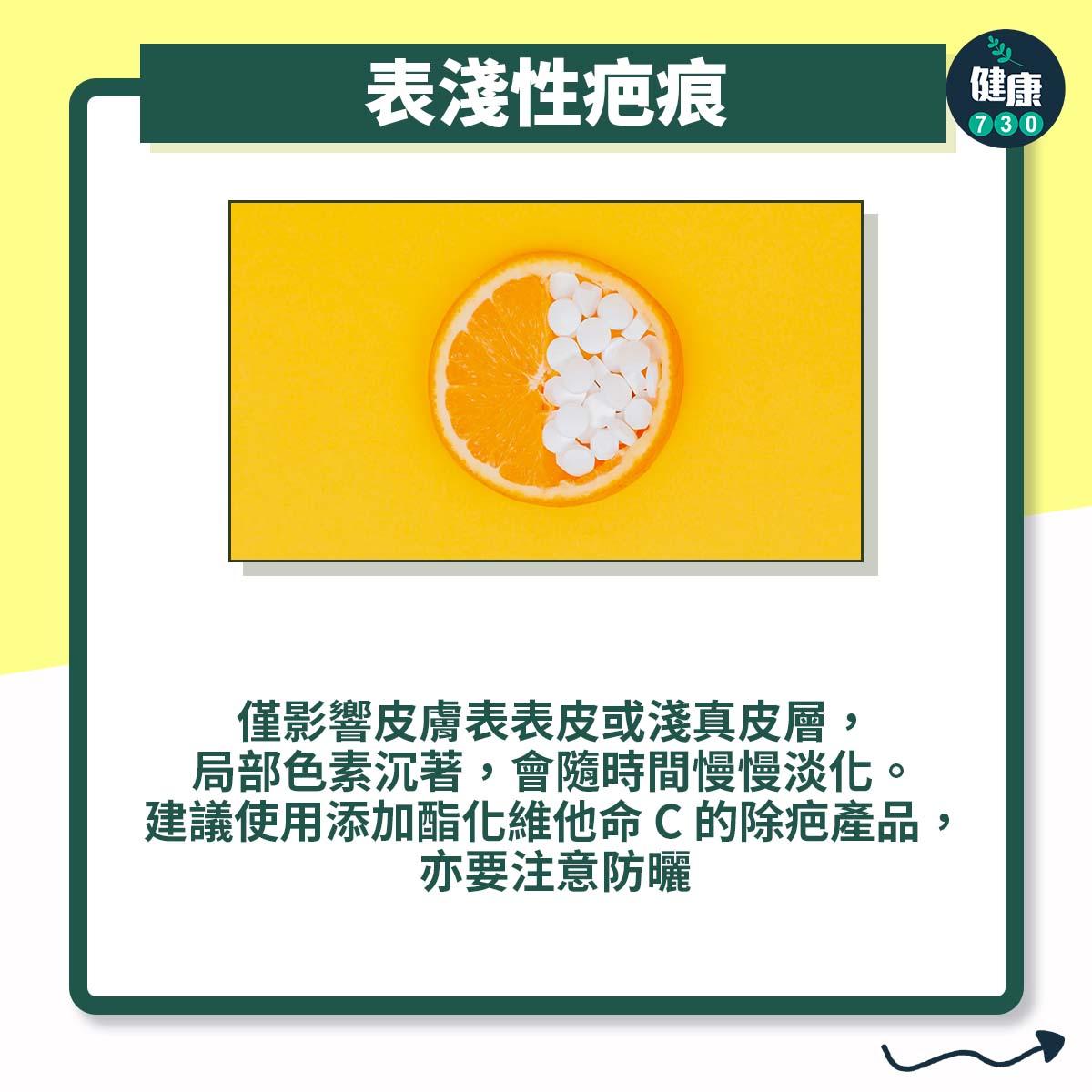 疤痕3大種類處理方法