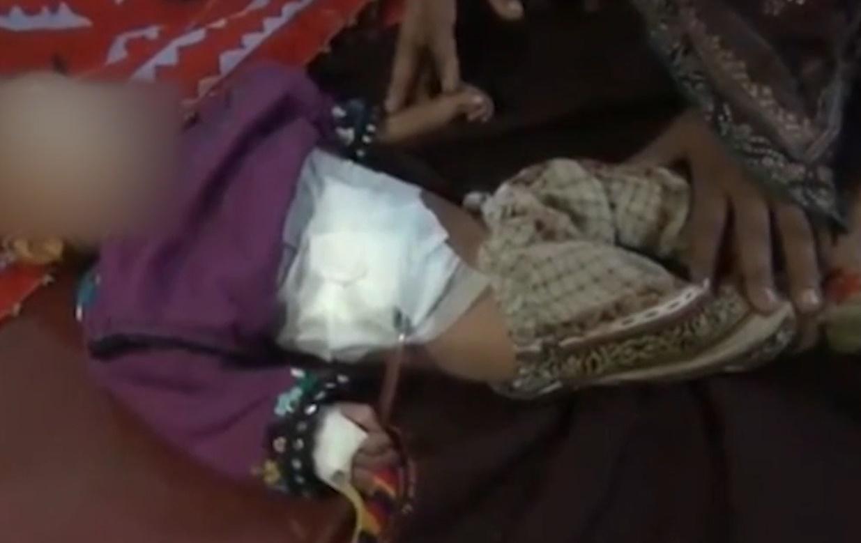 醫生指,女嬰手術成功,目前情況穩定,正在康復。(X)