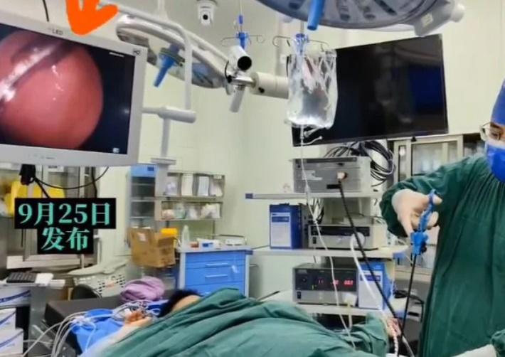 醫生將整支6.5厘米長的殘餘探熱針取出。(微博)