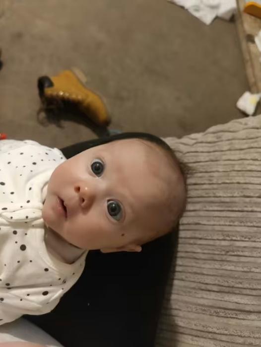 母親自責:「如果早知,她右眼或者不會盲」。(網上圖片)