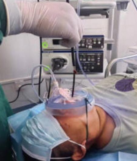 後來醫生通過全身麻醉,將水蛭取出。(網上圖片)