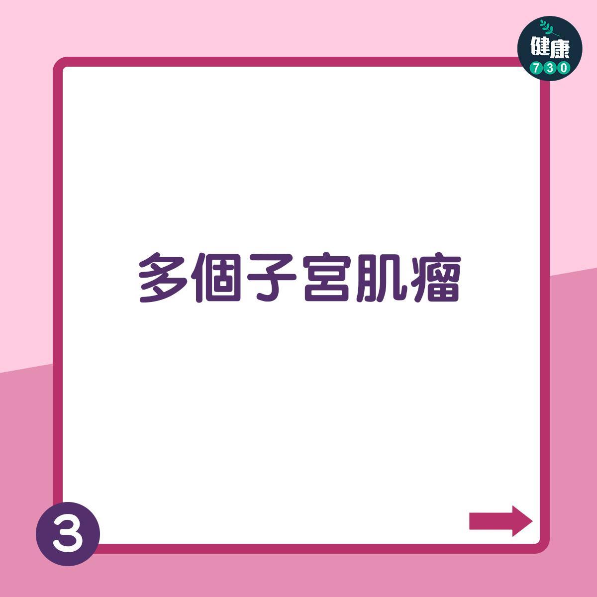 墮胎|家計會終止懷孕詳情(am730製圖)