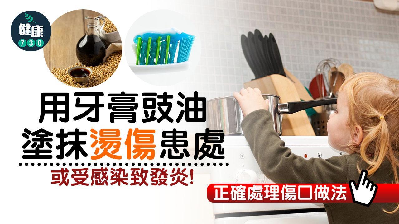 燙傷處理方法(am730製圖)