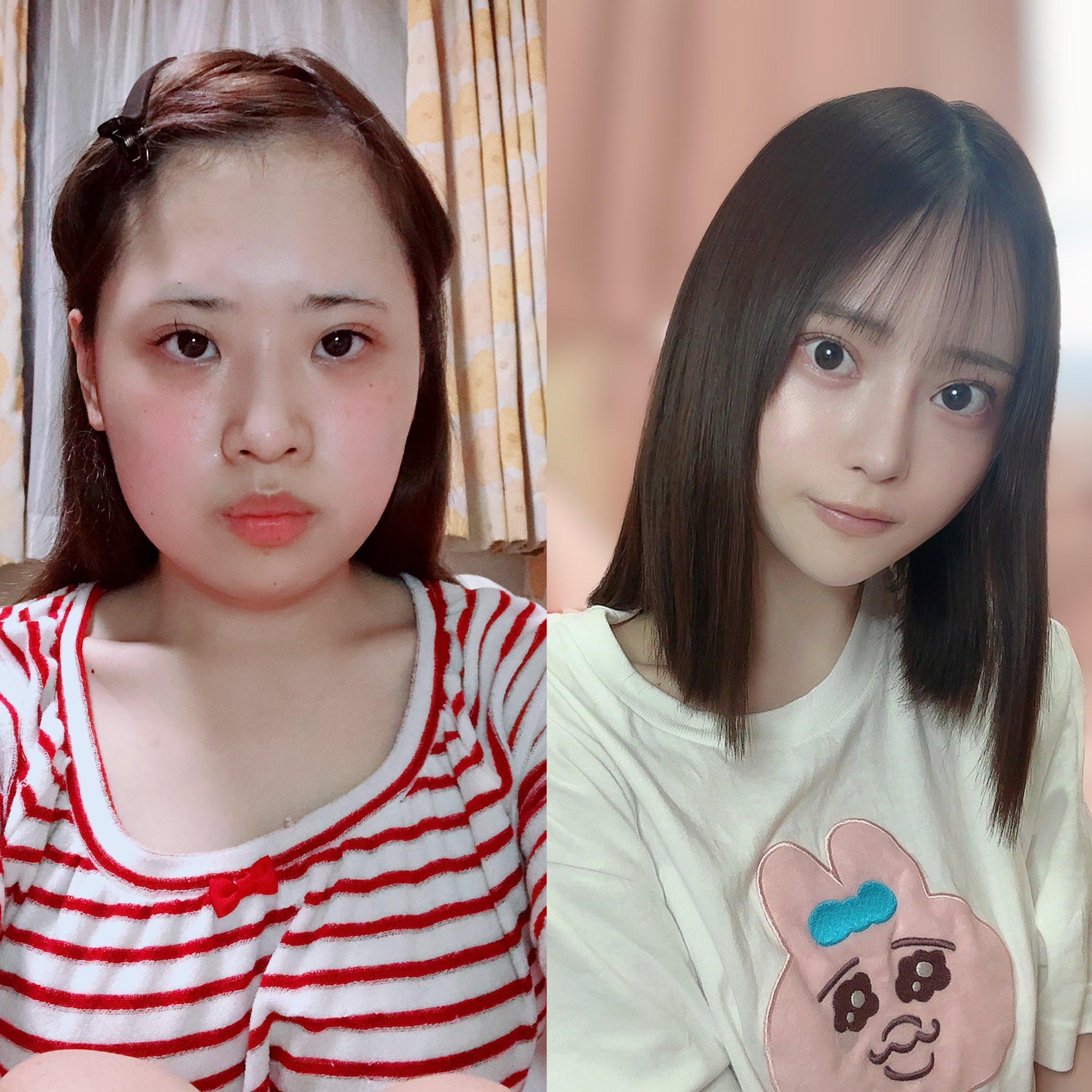 整容|日本網紅Karin砸逾42萬大改造,效果獲網民大讚(karinntter X)