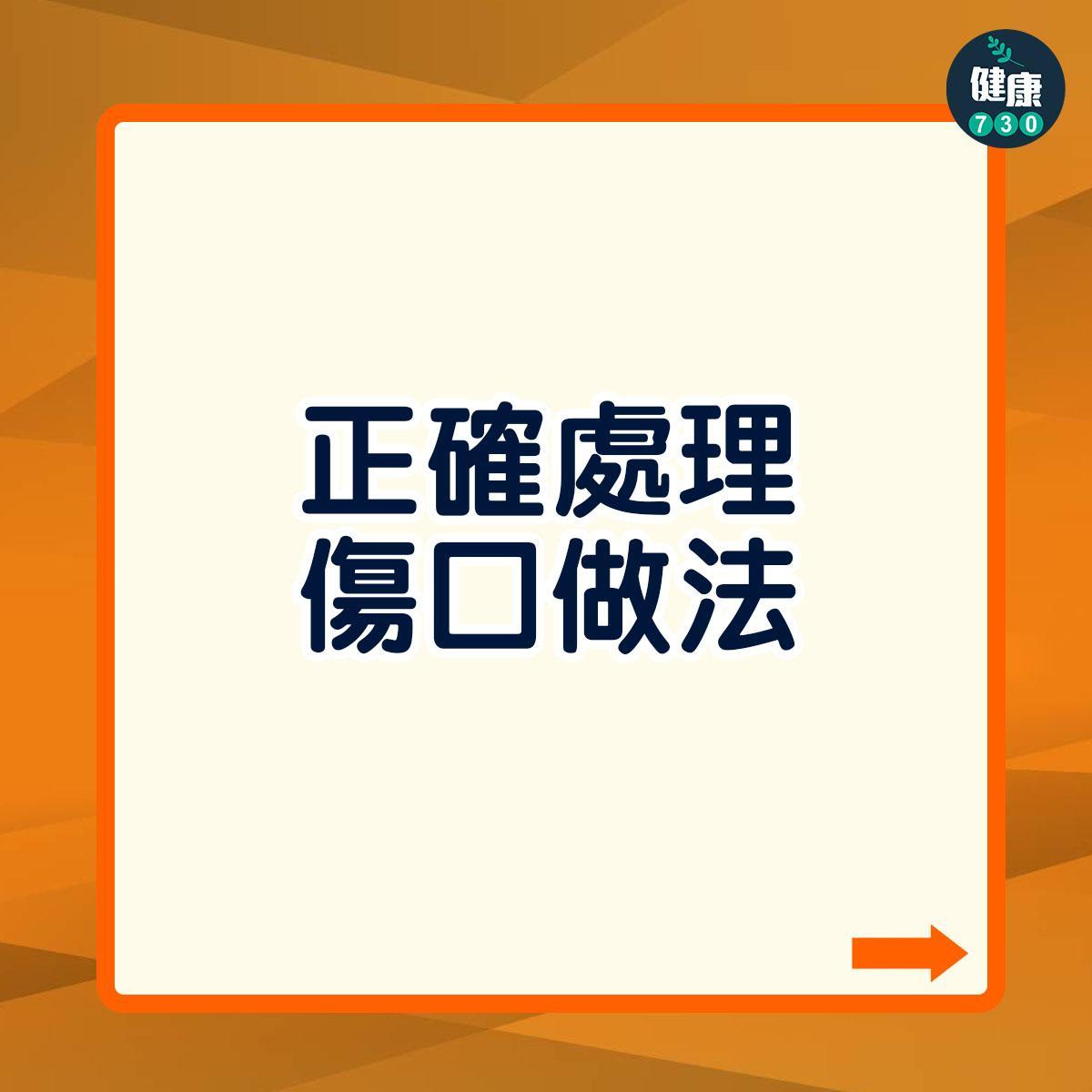 燙傷處理方法(am730製圖)