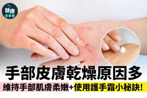 手部皮膚乾燥原因及護手霜用法(am730製圖)