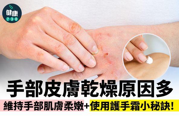 手部皮膚乾燥原因及護手霜用法(am730製圖)