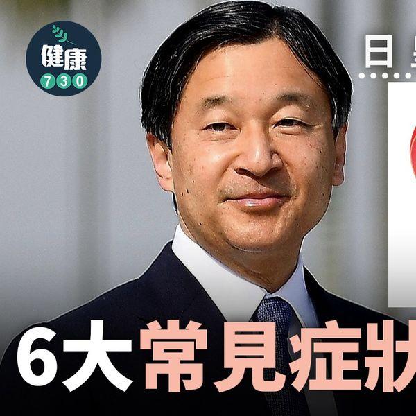 前列腺肥大原因、症狀及預防方法(am730製圖)