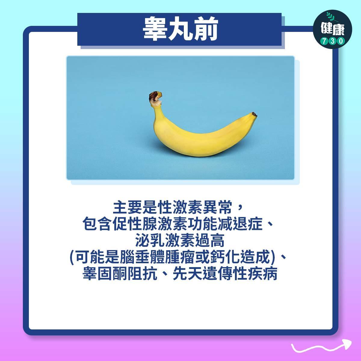 不育原因|男性不孕症(am730製圖)