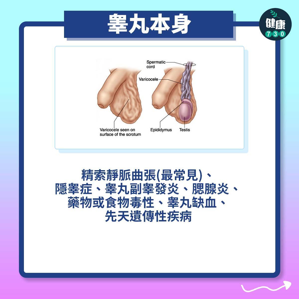 不育原因|男性不孕症(am730製圖)