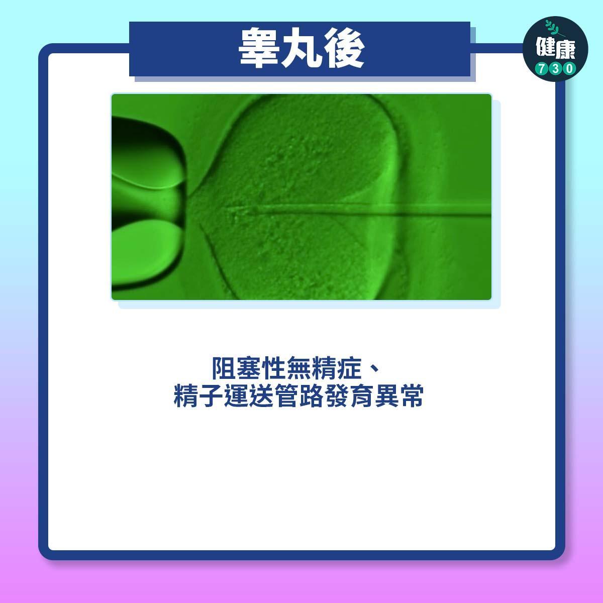 不育原因|男性不孕症(am730製圖)