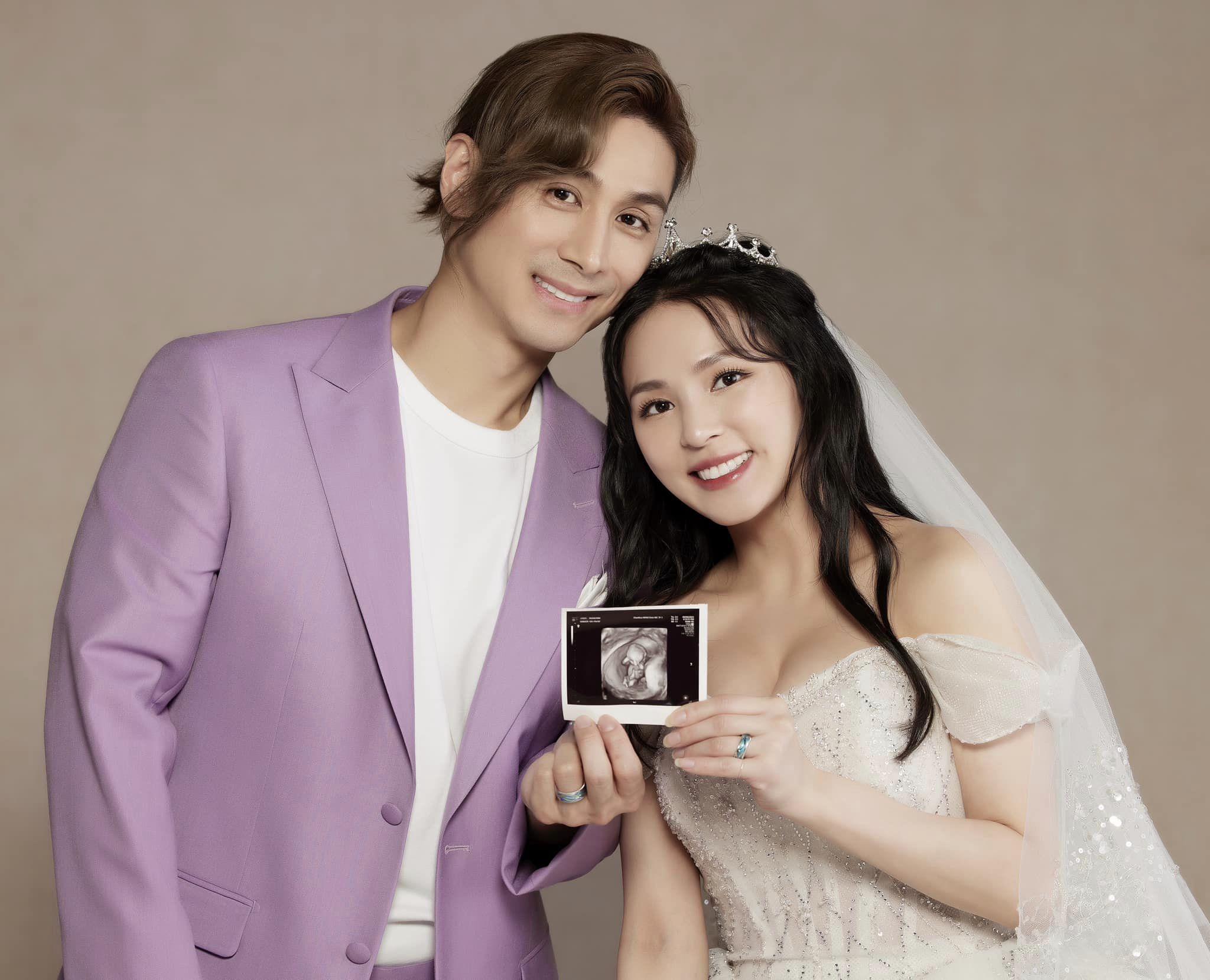 熊熊與身老公Mars,一同拿著超音波照宣布有喜(熊熊IG)