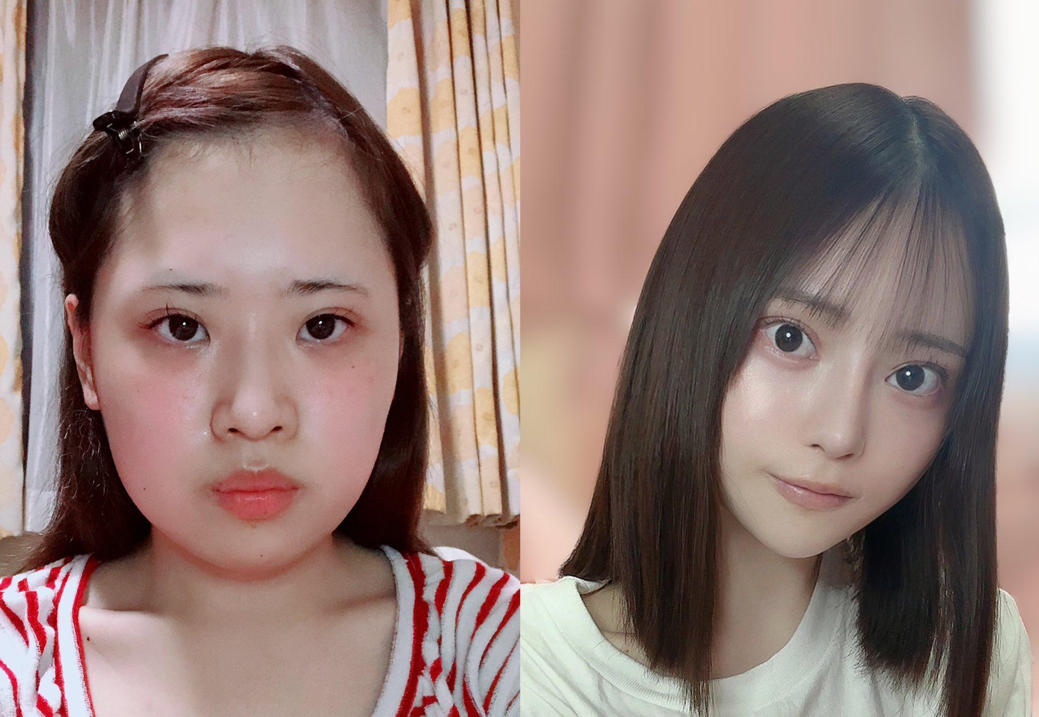整容|日本網紅Karin砸逾42萬大改造 開眼頭、抽脂等10項手術