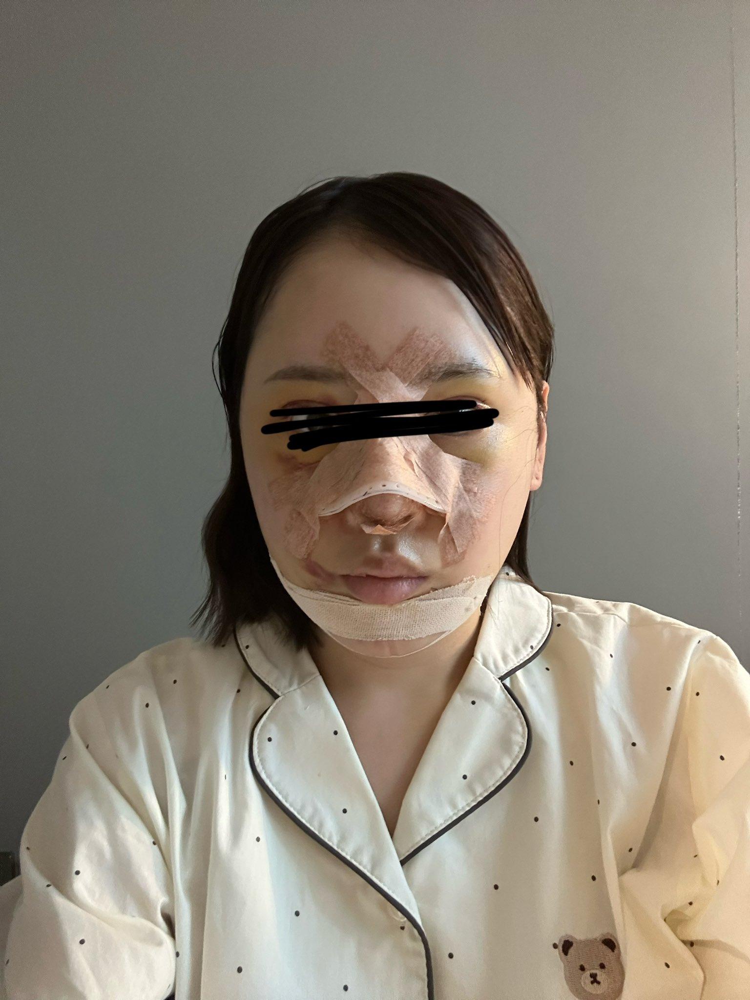 整容|日本網紅かりんKarin整形前外表。(karinntter X)