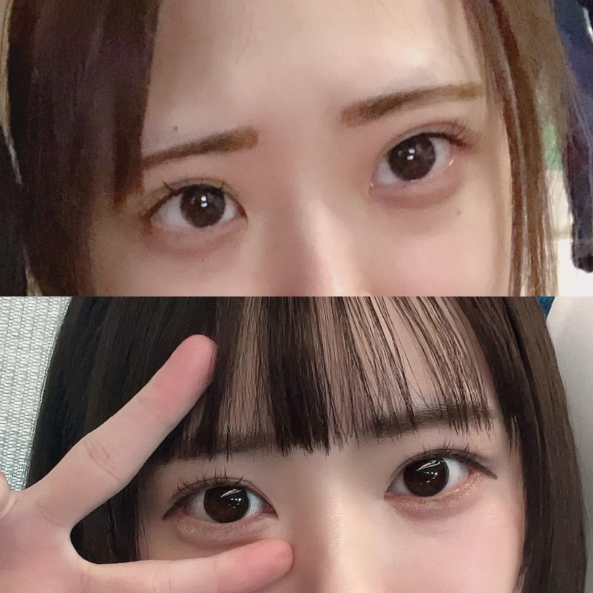 整容|日本網紅Karin砸逾42萬大改造,包括開眼頭及眼尾