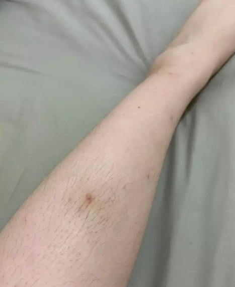 名女生就表示NIVEA所推出的一款美白潤膚露就很符合性價比高的原則,只因其價錢價錢平,一大枝只需約$30之餘,美白及保濕效果均不錯,惟用後除了會擁有白滑皮膚外,更要承受瘋狂生毛的後果!(圖片來源:Dcard討論區)