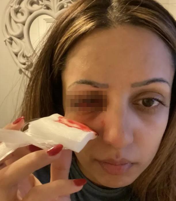 醫生:即使接受角膜手術,也不保證恢復視力。(X)