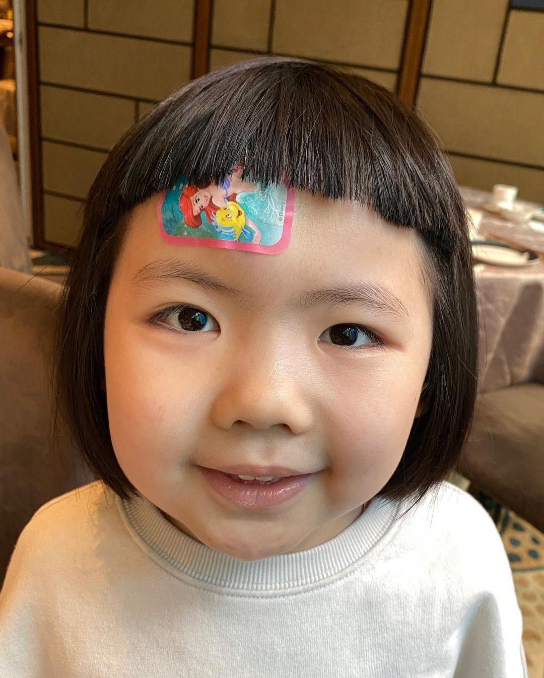 李璨琛同太太梁志瑩嘅5歲大女李元元(Lucy)因家居意外撞傷前額(李元元IG)