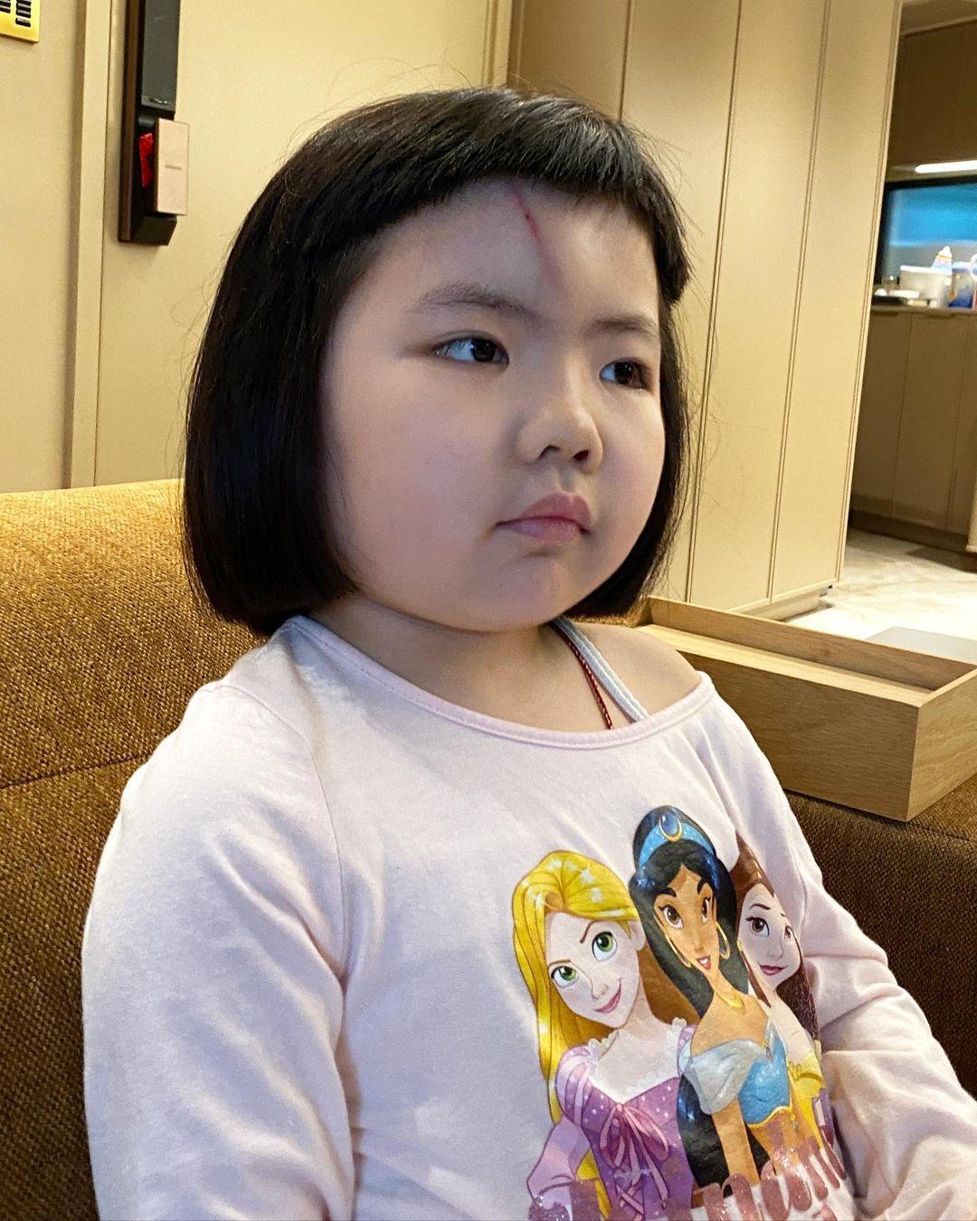 李璨琛同太太梁志瑩嘅5歲大女李元元(Lucy)因家居意外撞傷前額(李元元IG)