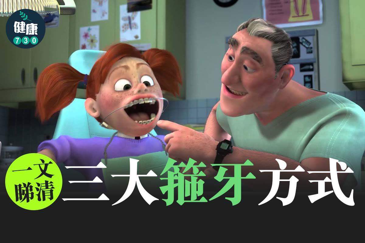 牙齒矯正|3個箍牙方法(am730製圖)