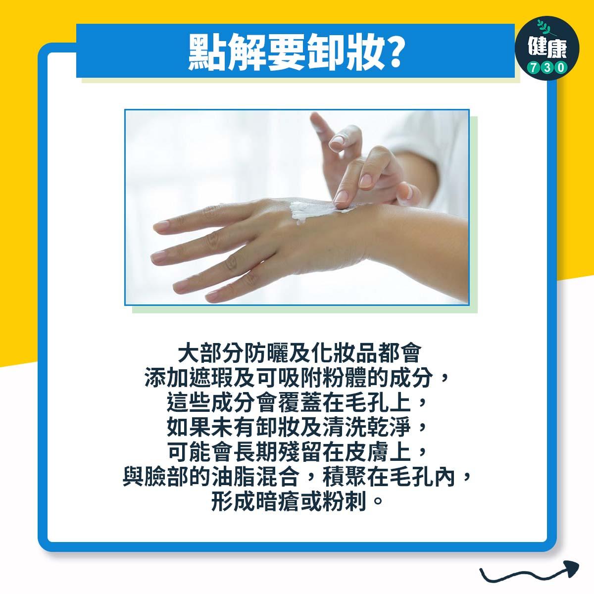 防曬卸妝不當或引致暗瘡或粉刺(am730製圖)