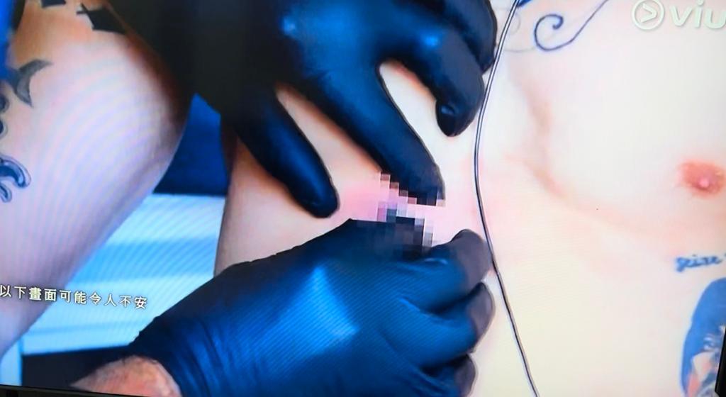 Mike導被橡膠子彈射入肉,要接受救治。(《無制限探險隊》截圖)