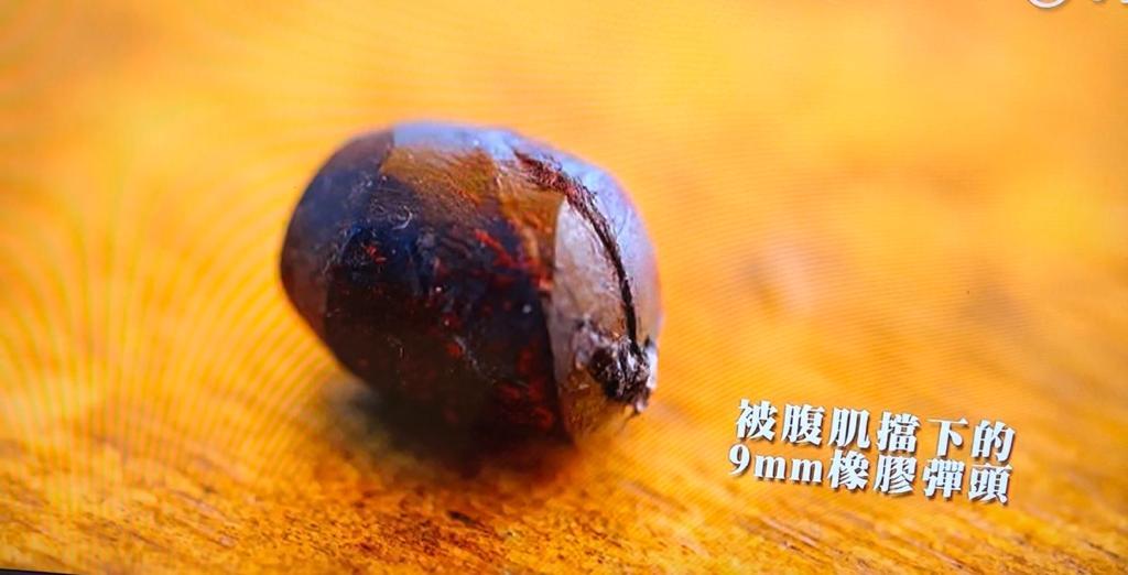 Mike導被9mm橡膠子彈射入肉,要接受救治。(《無制限探險隊》截圖)