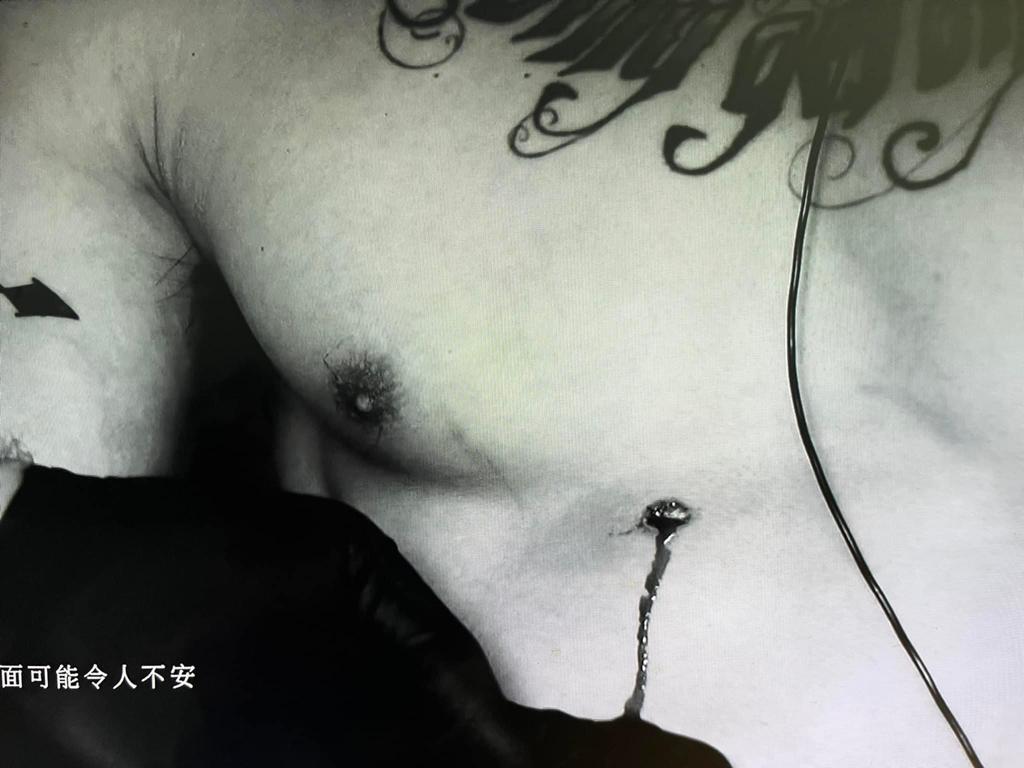 Mike導被9mm的橡膠子彈射入肉。(《無制限探險隊》截圖)